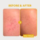 TIRTIR - Pure Vitamin C24 Serum 30 ml