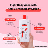 TIAM - Anti Blemish Body Lotion Back & Chest 200 ml