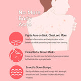 TIAM - Anti Blemish Body Lotion Back & Chest 200 ml