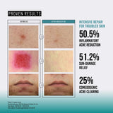 Jumiso Snail Mucin 95+ Ppetide Facial Essence 140ML