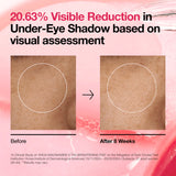 Anua Niacinamide 5 TXA Brightening 60 Pad