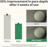 Axis Y LHA Peel & Fill Pore Balancing Cream 50ml