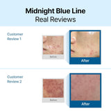 Dear Klairs Midnight Blue Calming Cream - 60g