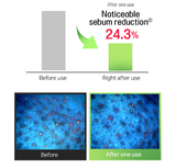 Frudia Pore Peeling Pad, Green Grape 1 Pad