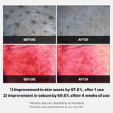 Medicube Red Succinct Acid Peeling 70 Pads