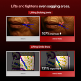 Meditherapy Collagen Wrinkle-fit Mask 1 Pc