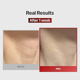 Meditherapy Wrinkle-Fit Neck Mask