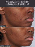 Paula's Choice Skin Perfecting 2% BHA Liquid Exfoliant for Clear Skin XL 236ml