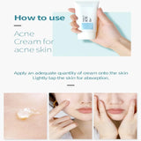 Pyunkang Yul ACNE Cream 50 ml