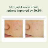 Pyunkang Yul Crema calmante Madecasoside Spot 30ML
