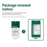 SOME BY MI 30 Days Miracle Clear Spot 18 Patch