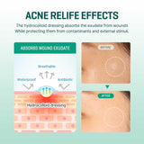 SOME BY MI 30 Days Miracle Clear Spot 18 Patch