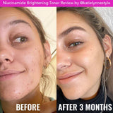 Good Molecules Niacinamide Brightening Toner 120 ml WITHOUT BOX