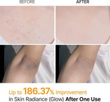 Dr.Melaxin Peel Shot Exfoliating Kojic Acid Turmeric Spray 200ml Expiry 02 - 2029