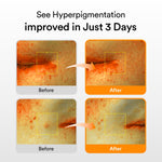 Abib Glutathiosome Dark Spot Serum Vita drop 50ml