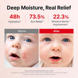 atopalm-mle-eczema-cream-65ml-