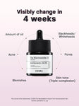 COSRX Niacinamide 15 Face Serum, Minimize Enlarged Pores, Redness Relief, Discoloration Correcting Treatment, Korean Skin Care, 0.67 fl.oz/20 ml