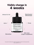 COSRX Niacinamide 15 Face Serum, Minimize Enlarged Pores, Redness Relief, Discoloration Correcting Treatment, Korean Skin Care, 0.67 fl.oz/20 ml