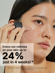 COSRX Niacinamide 15 Face Serum, Minimize Enlarged Pores, Redness Relief, Discoloration Correcting Treatment, Korean Skin Care, 0.67 fl.oz/20 ml