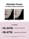COSRX Niacinamide 15 Face Serum, Minimize Enlarged Pores, Redness Relief, Discoloration Correcting Treatment, Korean Skin Care, 0.67 fl.oz/20 ml