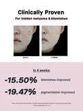 COSRX Niacinamide 15 Face Serum, Minimize Enlarged Pores, Redness Relief, Discoloration Correcting Treatment, Korean Skin Care, 0.67 fl.oz/20 ml