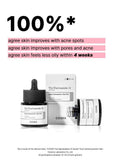 COSRX Niacinamide 15 Face Serum, Minimize Enlarged Pores, Redness Relief, Discoloration Correcting Treatment, Korean Skin Care, 0.67 fl.oz/20 ml