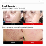 FRANKLY Retinol 0.3 Cream 20ml