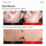 FRANKLY Retinol 0.3 Cream 20ml