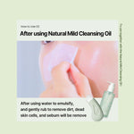 ILSO Deep Clean Master Blackhead Remover Tool