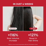 moev Anukatin Shampoo 300ml