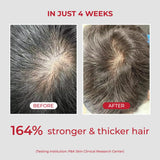 moev Anukatin Shampoo 300ml