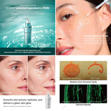 REJURAN Turnover Ampule 30ml