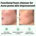 SOME BY MI AHA BHA PHA 30Days Miracle Acne Clear Foam Cleanser 100ml